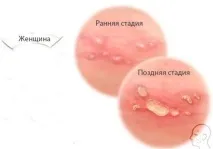 жінок