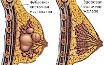 причини