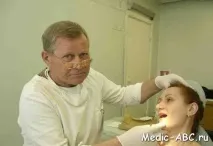Як лікувати запалення слинної залози запалення