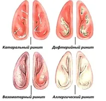 разновидности