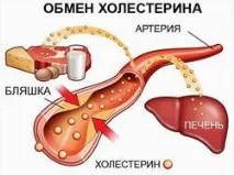 Як зменшити холестерин у крові продуктами чи ліками продуктами