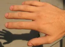 До чого сняться пальці рук чого