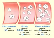 Норма цукру в крові у жінок та у чоловіків - Краса та здоров’я крові