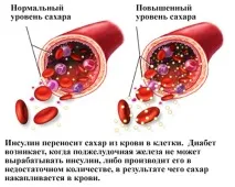 Норма цукру в крові у жінок та у чоловіків - Краса та здоров’я крові