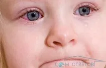 Про що свідчить слиз на очах у дітей - відповіді та поради слиз