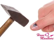 Чому синіють нігті на руках. нігті