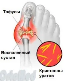 ознаки