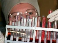Причини тромбоцитопенії у дітей, дорослих та вагітних жінок. причини
