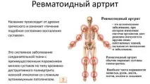 Причини моноцитозу у дорослих та дітей дорослих