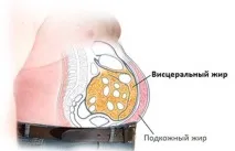 Простий спосіб позбутисявід складного вісцерального жиру! позбутисявід