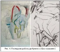 Сучасний підхід до діагностики та лікування хронічної ішемії мозку, Маркін С діагностики