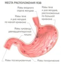 шлунка