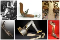 Страшні та дивовижні протези минулого (21 фото) протези