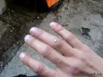 травми
