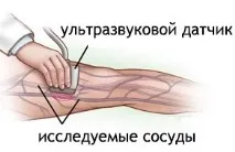 УЗД судин у Запоріжжі в центрі НейроМедика судин