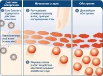 концепция