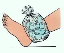 Вивих гомілкостопа симптоми, лікування, фото симптоми
