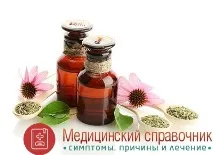 Запалення лімфовузлів на шиї, в паху - симптоми, причини, лікування запалення