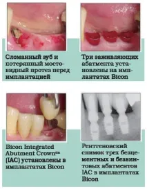 владикавказ