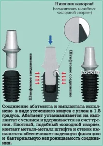 импланта