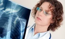 Аспіраційна пневмонія причини, симптоми, лікування причини