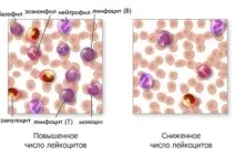Аналіз крові на лейкоцити крові