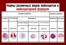 Аналіз крові на лейкоцити лейкоцити