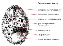 балантидіаз