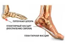 причини