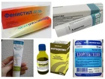 Що робити, якщо мошка вкусила в око або повіку робити