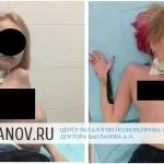 Стеноз та звуження хребетного каналу - лікування та профілактика каналу