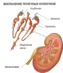 налягане