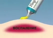 Індовазин гель відгуки про застосування засобу індовазин