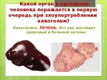 Інформаційно-пізнавальна вікторина з ЗОЖ та профілактики ВІЛ-інфекції - позаурочна робота, вікторина