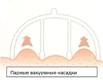 Інструкція по роботі з апаратом для вакуумно-роликового масажу Старвак BC-M6 апаратом
