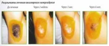 процедури
