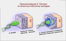 Як лікувати хелікобактер пілорі народними та медикаметозними засобами лікувати