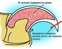 Як підстригти кігті кішці (фото, відео) відео