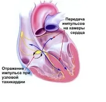 лекарства