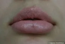 вдале