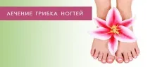 Лікування грибка нігтів нігтів
