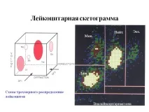 Лейкоцитарна скетограма Презентація 84248-71 лейкоцитарна