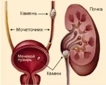 Сечокам’яна хвороба у котів, Кішки, Коти та Кошенята - Мишок НІ! котів