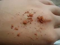 Мій камуфляж Розгорнута
