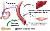 Народні рецепти від цукрового діабету 1 типу діабету