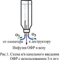 озонотерапията