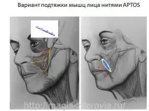 ниток