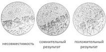 Постікоітальний тест ((проба Шуварського) показання, розшифровка тест