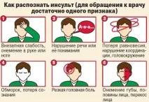 Ознаки міні інсульту - Лікування Серця лікування