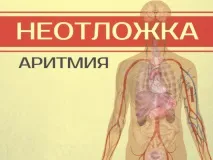 Як лікувати в домашніх умовах напад аритмії лікувати